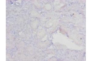 Immunohistochemistry of paraffin-embedded human kidney tissue using ABIN7159622 at dilution of 1:20 (MGMT Antikörper  (AA 4-207))