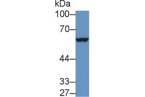 Western Blot; Sample: Mouse Placenta lysate; Primary Ab: 1µg/ml Rabbit Anti-Mouse IL9R Antibody Second Ab: 0.