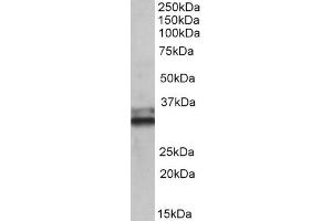ABIN571194 (0. (ETFA Antikörper  (AA 139-152))