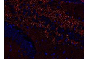 Indirect immunostaining of PFA fixed paraffin embedded mouse hippocampus section (dilution 1 : 500; red). (VAMP1, 2, 3 (AA 1-81) Antikörper)