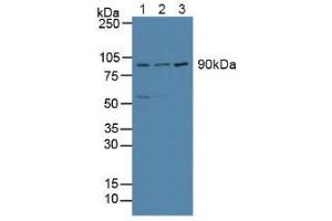 Figure. (ATF6 Antikörper  (AA 1-377))