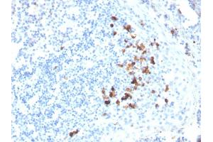 Formalin-fixed, paraffin-embedded human tonsil stained with IgA Mouse Monoclonal Antibody (HISA43). (IGHA1 & IGHA2 Antikörper)
