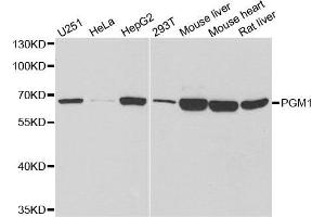 Western Blotting (WB) image for anti-Phosphoglucomutase 1 (PGM1) antibody (ABIN1980319)