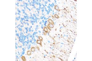 Immunohistochemistry of paraffin-embedded Mouse brain using MMP17 Rabbit pAb (ABIN3017219, ABIN3017220, ABIN3017221 and ABIN1680859) at dilution of 1:100 (40x lens). (MMP17 Antikörper)