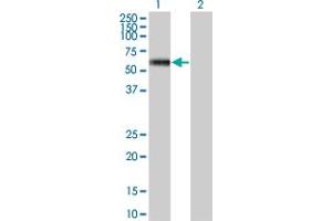 Western Blot analysis of MKNK1 expression in transfected 293T cell line by MKNK1 monoclonal antibody (M09), clone 3C9. (MKNK1 Antikörper  (AA 1-465))