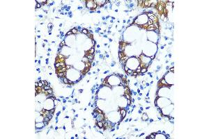 Immunohistochemistry of paraffin-embedded human colon using FUT4 Rabbit pAb (ABIN7267274) at dilution of 1:100 (40x lens). (CD15 Antikörper  (AA 200-300))
