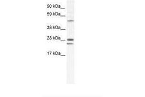 Image no. 1 for anti-Gap Junction Protein, beta 2, 26kDa (GJB2) (AA 85-134) antibody (ABIN202090) (GJB2 Antikörper  (AA 85-134))
