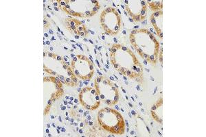Immunohistochemistry (IHC) image for anti-Phosphoglycerate Kinase 1 (PGK1) (AA 117-145) antibody (ABIN5531821)