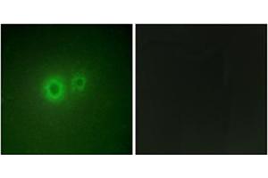 Immunofluorescence analysis of HuvEc cells, using LRAT Antibody . (LRAT Antikörper  (Internal Region))