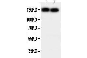 Anti-N Cadherin antibody, Western blotting Lane 1: MCF-7 Cell Lysate Lane 2: HELA Cell Lysate