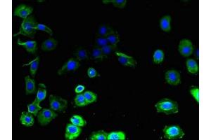 Immunofluorescent analysis of A431 cells using ABIN7153629 at dilution of 1:100 and Alexa Fluor 488-congugated AffiniPure Goat Anti-Rabbit IgG(H+L) (GJB7 Antikörper  (AA 41-75))