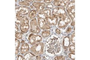 Immunohistochemical staining of human kidney with GINS4 polyclonal antibody  shows moderate cytopolasmic positivity in tubular cells. (GINS4 Antikörper)