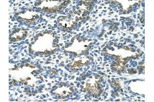 ALPP antibody was used for immunohistochemistry at a concentration of 4-8 ug/ml to stain Alveolar cells (arrows) in Human Lung.