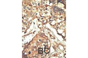 Immunohistochemistry (Paraffin-embedded Sections) (IHC (p)) image for anti-Protein Kinase, DNA-Activated, Catalytic Polypeptide (PRKDC) (AA 4075-4104), (C-Term) antibody (ABIN6243168)