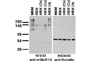 anti-Glutamate Receptor, Metabotropic 5/1 (mGluR1/5) (AA 824-1203), (C-Term), (Cytosolic) antibody