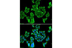 Immunofluorescence analysis of HeLa cells using CCAR1 antibody (ABIN6291285). (CCAR1 Antikörper)