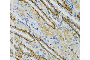 Immunohistochemistry of paraffin-embedded Mouse kidney using COG2 Polyclonal Antibody at dilution of 1:100 (40x lens). (COG2 Antikörper)
