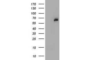 Western Blotting (WB) image for anti-Phosphoglucomutase 3 (PGM3) antibody (ABIN1500178) (Phosphoglucomutase 3 Antikörper)
