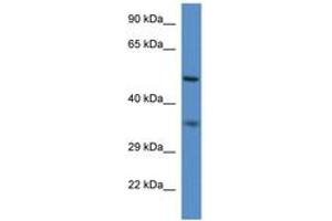 Image no. 1 for anti-Peroxisomal Biogenesis Factor 2 (PEX2) (N-Term) antibody (ABIN6746208) (PEX2 Antikörper  (N-Term))