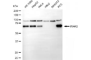 Western blotting analysis using IRAK2 antibody (ABIN7799114).