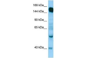 WB Suggested Anti-RAPGEF6 Antibody Titration: 1. (RAPGEF6 Antikörper  (N-Term))