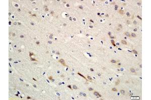 Formalin-fixed and paraffin embedded rat brain tissue labeled with Rabbit Anti-Erbin Polyclonal Antibody, Unconjugated (ABIN2173874) at 1:200 followed by conjugation to the secondary antibody and DAB staining