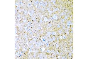 Immunohistochemistry of paraffin-embedded rat brain using WNT2 antibody (ABIN6130801, ABIN6150239, ABIN6150241 and ABIN6221571) at dilution of 1:200 (40x lens).
