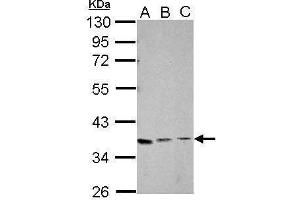 WB Image Sample (30 ug of whole cell lysate) A: Jurkat B: K562 C: HL-60 10% SDS PAGE antibody diluted at 1:1000 (XRCC4 Antikörper  (C-Term))