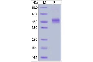 Biotinylated Cynomolgus CD64, His,Avitag on  under reducing (R) condition.