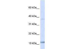 WB Suggested Anti-NHLH1 Antibody Titration:  0.