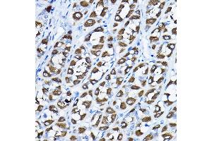 Immunohistochemistry of paraffin-embedded rat stomach using PGLS Rabbit pAb (ABIN6131432, ABIN6145509, ABIN6145510 and ABIN6224398) at dilution of 1:200 (40x lens). (PGLS Antikörper  (AA 1-258))