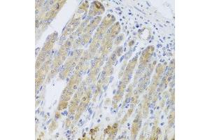 Immunohistochemistry of paraffin-embedded mouse stomach using RARS2 antibody at dilution of 1:100 (x40 lens). (RARS2 Antikörper)