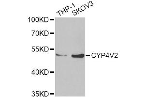 Western blot analysis of extracts of various cell lines, using CYP4V2 Antibody (ABIN2562110) at 1:1000 dilution. (CYP4V2 Antikörper)