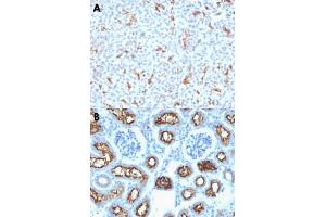 Immunohistochemical staining (Formalin-fixed paraffin-embedded sections) of human pancreas (A) and mouse kidney (B) with CFTR monoclonal antibody, clone CFTR/1342 . (CFTR Antikörper)