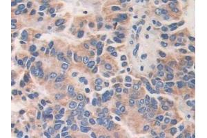 Immunohistochemistry (IHC) image for anti-A Kinase (PRKA) Anchor Protein 11 (AKAP11) (AA 1650-1901) antibody (ABIN7443557)