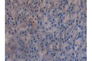 Immunohistochemistry (IHC) image for anti-GRB2-Associated Binding Protein 3 (GAB3) (AA 142-375) antibody (ABIN7443473)
