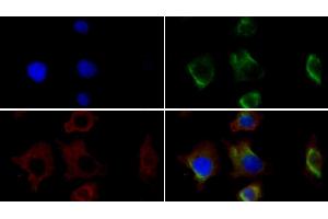 Detection of VIM in Human HepG2 cell using Monoclonal Antibody to Vimentin (VIM) (Vimentin Antikörper)