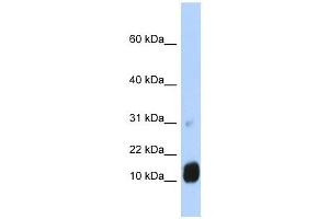 GCHFR antibody used at 1 ug/ml to detect target protein.