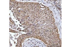 IHC analysis of 14-3-3 gamma/YWHAG using anti-14-3-3 gamma/YWHAG antibody (ABIN7600596).