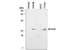 Image no. 1 for anti-V-Ral Simian Leukemia Viral Oncogene Homolog B (Ras Related, GTP Binding Protein) (Ralb) antibody (ABIN204644) (RALB Antikörper)