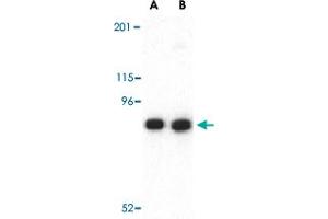 Western blot analysis of CDH13 in NIH/3T3 lysate with CDH13 polyclonal antibody  at (A) 0.
