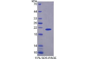 SDS-PAGE analysis of Rat PYGL Protein. (PYGL Protein)