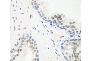 Immunohistochemistry of paraffin-embedded Human prostate using PPAN Polyclonal Antibody at dilution of 1:200 (40x lens).
