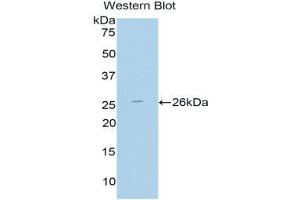 Western Blotting (WB) image for anti-Thyroid Peroxidase (TPO) (AA 19-846) antibody (ABIN1860847) (Thyroperoxidase Antikörper  (AA 19-846))