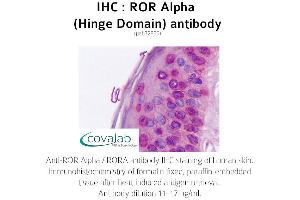 Image no. 2 for anti-RAR-Related Orphan Receptor A (RORA) antibody (ABIN1738922) (RORA Antikörper)