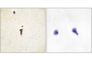 Immunohistochemistry (IHC) image for anti-Intestinal Cell (MAK-Like) Kinase (ICK) (AA 241-290) antibody (ABIN2889811) (ICK Antikörper  (AA 241-290))