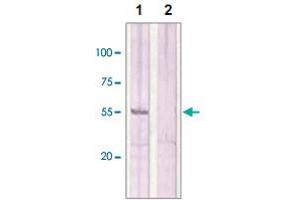 The whole cell lysates derived from MCF-7 were immunoblotted by ESR2 polyclonal antibody  at 1 : 500 (Lane 1). (ESR2 Antikörper  (C-Term))