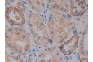 Detection of VSNL1 in Human Kidney Tissue using Polyclonal Antibody to Visinin Like Protein 1 (VSNL1) (VSNL1 Antikörper  (AA 39-184))
