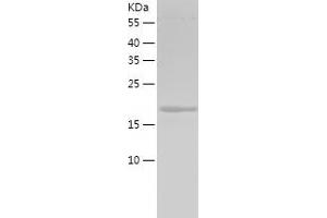 Western Blotting (WB) image for Fibroblast Growth Factor 18 (FGF18) (AA 28-207) protein (His tag) (ABIN7122927) (FGF18 Protein (AA 28-207) (His tag))