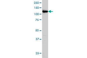 HIP1 monoclonal antibody (M01), clone 1F12 Western Blot analysis of HIP1 expression in HeLa . (HIP1 Antikörper  (AA 928-1037))